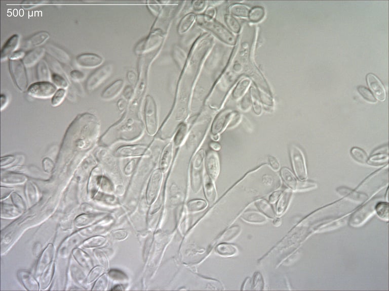 A close-up of dark, olive-black yeast-like colonies of Aureobasidium pullulans growing on a plant surface, with a slimy, shiny texture typical of this fungus.