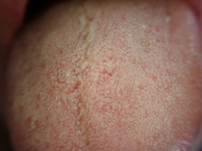 Cellule ovali di lievito di Candida albicans osservate al microscopio, in parte trasformate in filamenti ifali allungati