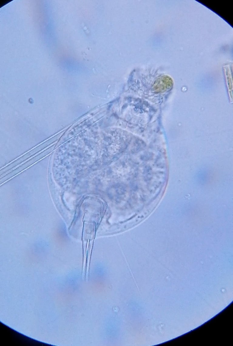 Um rotífero microscópico da espécie Lepadella glossa, com corpo revestido por uma lórica achatada e transparente